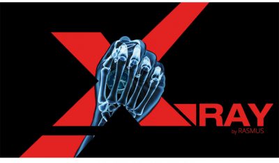 X-Ray by Rasmus Reviews